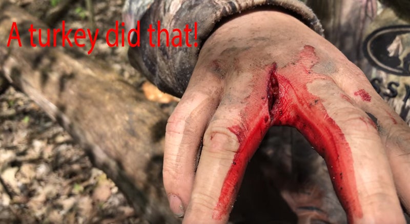 A “Dead” Turkey Can and Will Hurt You